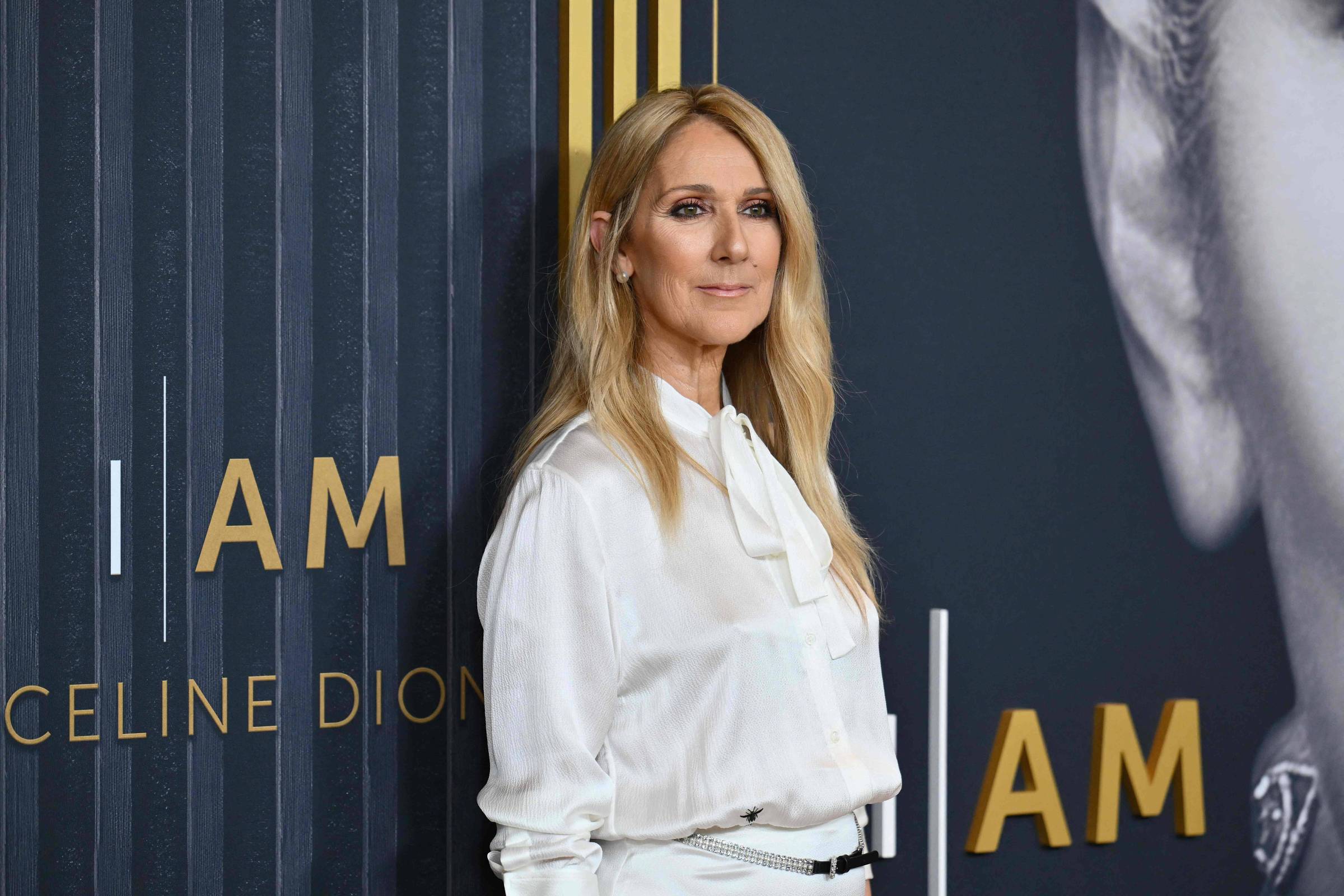 Céline Dion deve voltar aos palcos após diagnóstico de síndrome rara